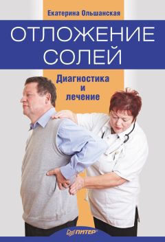 Екатерина Ольшанская - Отложение солей. Диагностика и правильное лечение