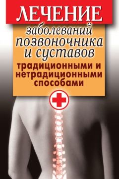 Дарья Нестерова - Лечение заболеваний позвоночника и суставов традиционными и нетрадиционными способами